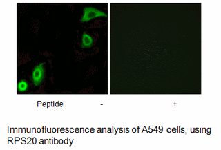 Product image for RPS20 Antibody