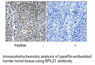 Product image for RPL23 Antibody