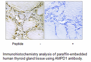 Product image for AMPD1 Antibody