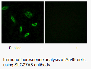 Product image for SLC27A5 Antibody