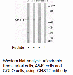 Product image for CHST2 Antibody