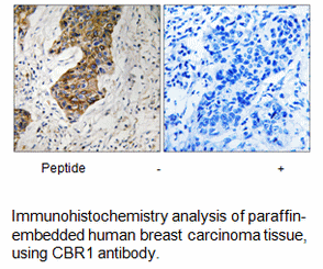 Product image for CBR1 Antibody