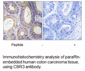 Product image for CBR3 Antibody