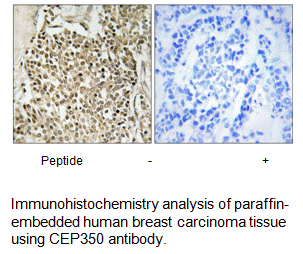 Product image for CEP350 Antibody