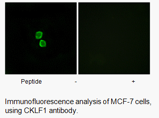 Product image for CKLF1 Antibody