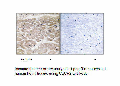 Product image for CBCP2 Antibody