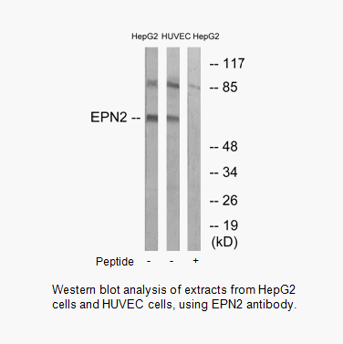 Product image for EPN2 Antibody