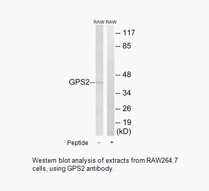 Product image for GPS2 Antibody