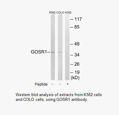 Product image for GOSR1 Antibody