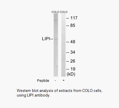 Product image for LIPI Antibody