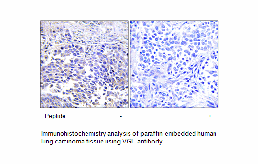 Product image for VGF Antibody