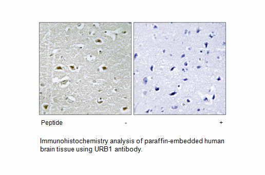 Product image for URB1 Antibody