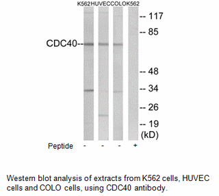 Product image for CDC40 Antibody