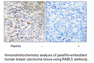 Product image for RABL5 Antibody