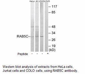 Product image for RAB5C Antibody