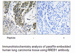 Product image for RREB1 Antibody