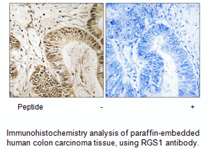 Product image for RGS1 Antibody