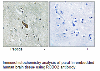 Product image for ROBO2 Antibody