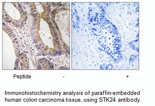 Product image for STK24 Antibody