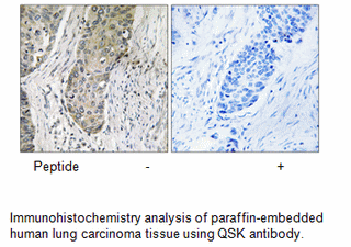 Product image for QSK Antibody