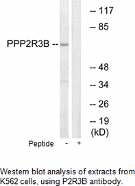 Product image for PPP2R3B Antibody