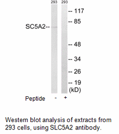 Product image for SLC5A2 Antibody