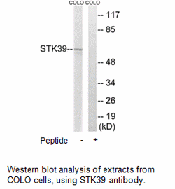 Product image for STK39 Antibody