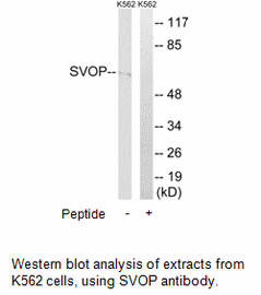 Product image for SVOP Antibody