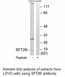 Product image for SFT2B Antibody