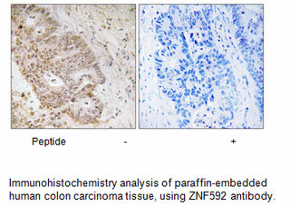 Product image for ZNF592 Antibody