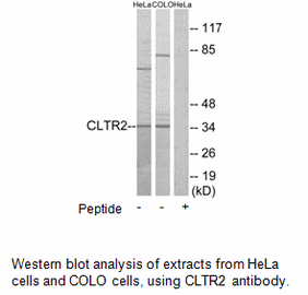 Product image for CLTR2 Antibody