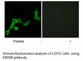 Product image for KISSR Antibody