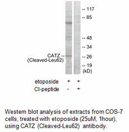 Product image for CATZ (Cleaved-Leu62) Antibody