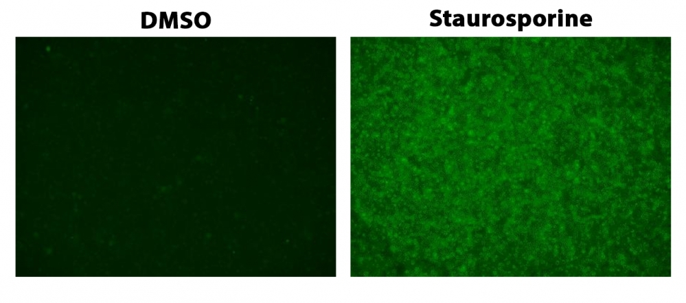 The detection of caspase 3/7 activity in Jurkat cells with ApoSight™ Green Caspase 3/7 substrate. Jurkat cells (200,000 cells/well/ 96-well plate) were treated with 1 μM Staurosporine or DMSO for 4 hours. Cells were incubated with Caspase 3/7 Substrate working solution at 37°C for 1 hour. Images were taken with a fluorescence microscope using a FITC filter set.