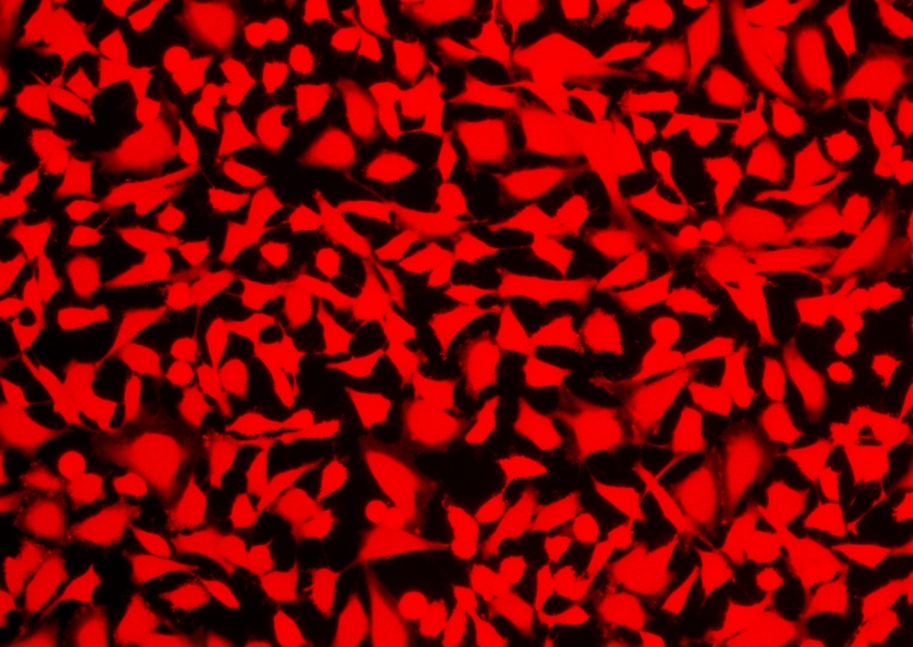 Image of HeLa cells stained with Cell Explorer™ Live Cell Labeling Kit *Red Fluorescence* (Cat#22609)in a Costar black wall/clear bottom 96-well plate. Cells were stained with Calcein Deep Red™ for 30 minutes and image was acquired with fluorescence microscope using Cy5 filter.