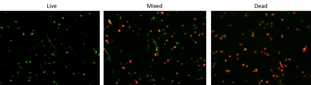 <p>Fluorescence images of <em>E. coli</em> HST08 stained with Cell Meter™ Bacterial Viability Assay Kit (Cat#22400). Live bacteria with intact cell membranes showed green fluorescence (Left), while 70% alcohol-killed dead bacteria (Right) with compromised membranes showed red fluorescence. Live and dead <em>E.coli</em> bacterial cells were also visualized in a mixed population (Middle). </p>