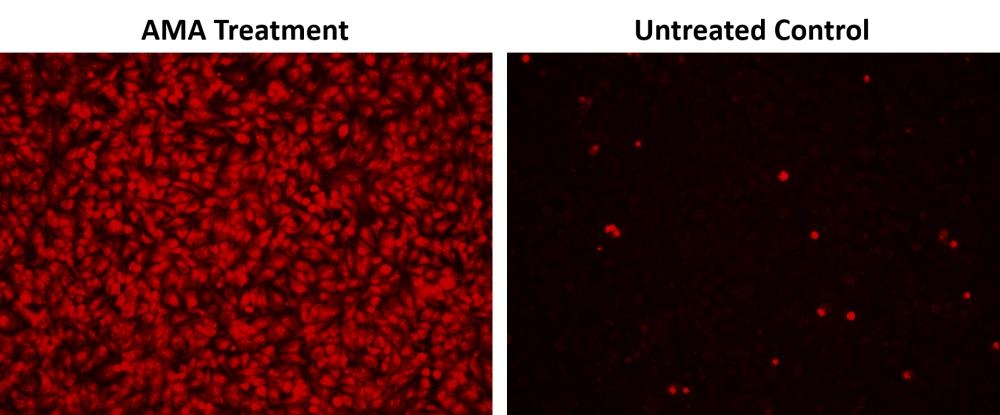Fluorescence images of superoxide measurement in HeLa cells using Cell Meter™ Fluorimetric Intracellular Superoxide Detection Kit (Cat#22971). HeLa cells at 100,000 cells/well/100 µL were seeded overnight in a 96-well black wall/clear bottom plate. AMA Treatment: Cells were treated with 50 µM Antimycin A (AMA) at 37 °C for 30 minutes, then incubated with MitoROS™ 580 for 1 hour. Untreated Control: HeLa cells were incubated with MitoROS™ 580 at 37 °C for 1 hour without AMA treatment. The fluorescence signal was measured using fluorescence microscope with a TRITC filter.