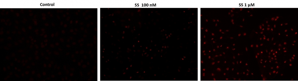 Fluorescence images of TUNEL reaction in HeLa cells with the treatment of 100 nM or 1 μM staurosporine (SS) for 4 hours as compare to untreated control. Cells were incubated with TUNEL working solution for 1 hour at 37ºC. The red fluorescence signal was analyzed using fluorescence microscope with a TRITC filter set. Fluorescently labeled DNA strand breaks shows intense fluorescent staining in SS treated cells.