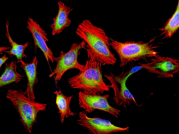 <p>Fluorescence image of HeLa cells fixed with 4% formaldehyde then stained with Cell Navigator® F-Actin Labeling Kit *Red Fluorescence* in a Costar black 96-well plate. Cells were labeled with iFluor® 594-Phalloidin (Cat#22664, Red) and nuclei stain DAPI (Cat#17507, Blue), respectively. Cell endoplasmic reticulum (ER) was stained with ER Green™ (Cat#22635, Green) before fixation.</p>