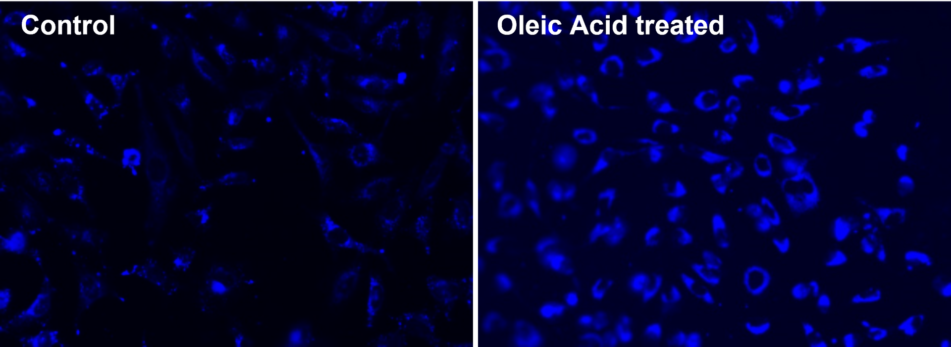 Fluorescence images of intracellular lipid droplets in control (Left) and Oleic Acid treated HeLa cells (Right) using Cell Navigator® Lipid Droplets Fluorescence Assay Kit. HeLa cells were incubated with 300 uM of Oleic Acid for 24 hours to induce intracellular lipid droplets formation. After washing with PBS, the cells were labeled with 1X Droplite™ Blue. Images were acquired with fluorescence microscope using DAPI filter set.