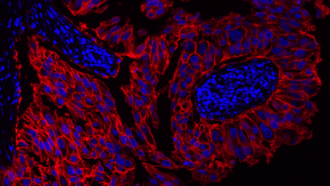 Fluorescence image of lung tissue stained for EpCAM. Lung tissue was incubated with an EpCAM primary antibody followed by a purified GXM HRP-conjugated secondary antibody. Signal was developed using a mixture of XFD 532 TSA (Cat. #11092) and iFluor® 532 PSA (Cat. #45023). Nuclei were counterstained with DAPI, and images were acquired using TRITC and DAPI filter sets.