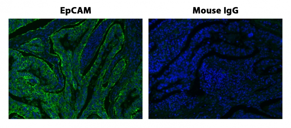Fluorescence IHC of formaldehyde-fixed, paraffin-embedded human lung adenocarcinoma positive tissue using iFluor<strong>™</strong> 450 Tyramide. Human lung adenocarcinoma positive tissue sections were stained with Mouse anti-EpCAM or Control Mouse IgG antibody and then incubated with polyHRP-labeled Goat anti-Mouse IgG secondary antibody followed by iFluor® 450 Tyramide™ (Cat#45097).