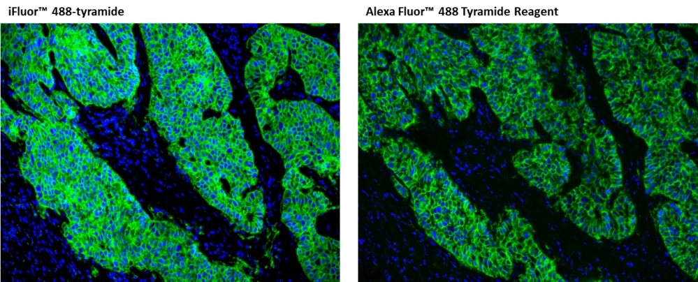Immunofluorescent image of paraffin-embedded human lung carcinoma labeled with  EpCAM Rabbit mAb followed with HRP-labeled goat anti-rabbit IgG (H+L) (Cat#16793) . The signal was developed with iFluor® 488 tyramide or Alexa Fluor™ 488 Tyramide Reagent (Green). Cells were also counterstained with DAPI (Blue).