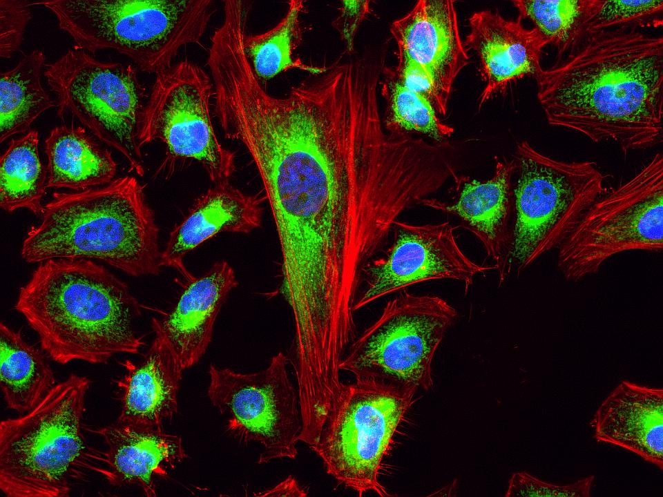 <p>Fluorescence images of HeLa cells stained with Phalloidin-iFluor® 633 Conjugate using fluorescence microscope with a Cy5 filter set. Live cells were stained with mitochondria dye MitoLite™ Green (Cat#22666, Green) and imaged. After fixation in 4% formaldehyde, the cells were labeled with F-actin dye iFluor® 633-Phalloidin (Red) and counterstained with Nuclear Blue™ DCS1 (Cat#17548, Blue).</p>