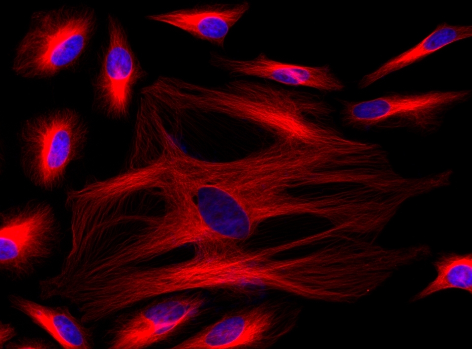 Immunofluorescence staining of tubulin in HeLa cells. HeLa cells were fixed with 4% PFA, permeabilized with 0.1% Triton X-100 and blocked. Cells were then incubated with mouse anti-tubulin monoclonal antibody and stained with a goat anti-mouse IgG labeled using the ReadiLink™ xtra Rapid Cy5 Antibody Labeling Kit (Cat No. 1972). The cell nuclei were counterstained using DAPI (Cat No. 17507).